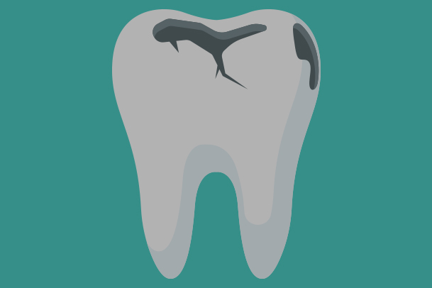 Care and Advice - Priors Hall Dental